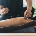 ¿Es la acupuntura un remedio eficaz para aliviar las contracturas musculares?
